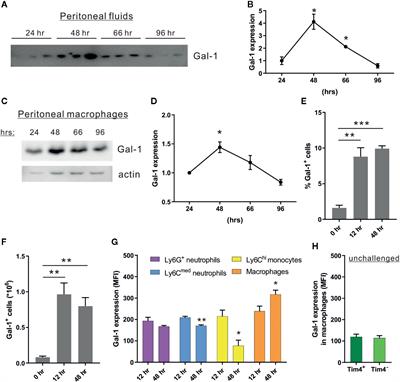 Galectin-1 Facilitates Macrophage Reprogramming and Resolution of Inflammation Through IFN-β